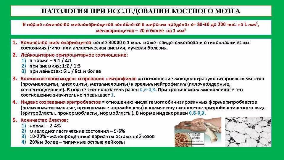 Костный мозг какие заболевания. Методика исследования костного мозга. Методи иследовании костного мозга. Исследования костного мозга показатели. Исследования костного мозга алгоритм.