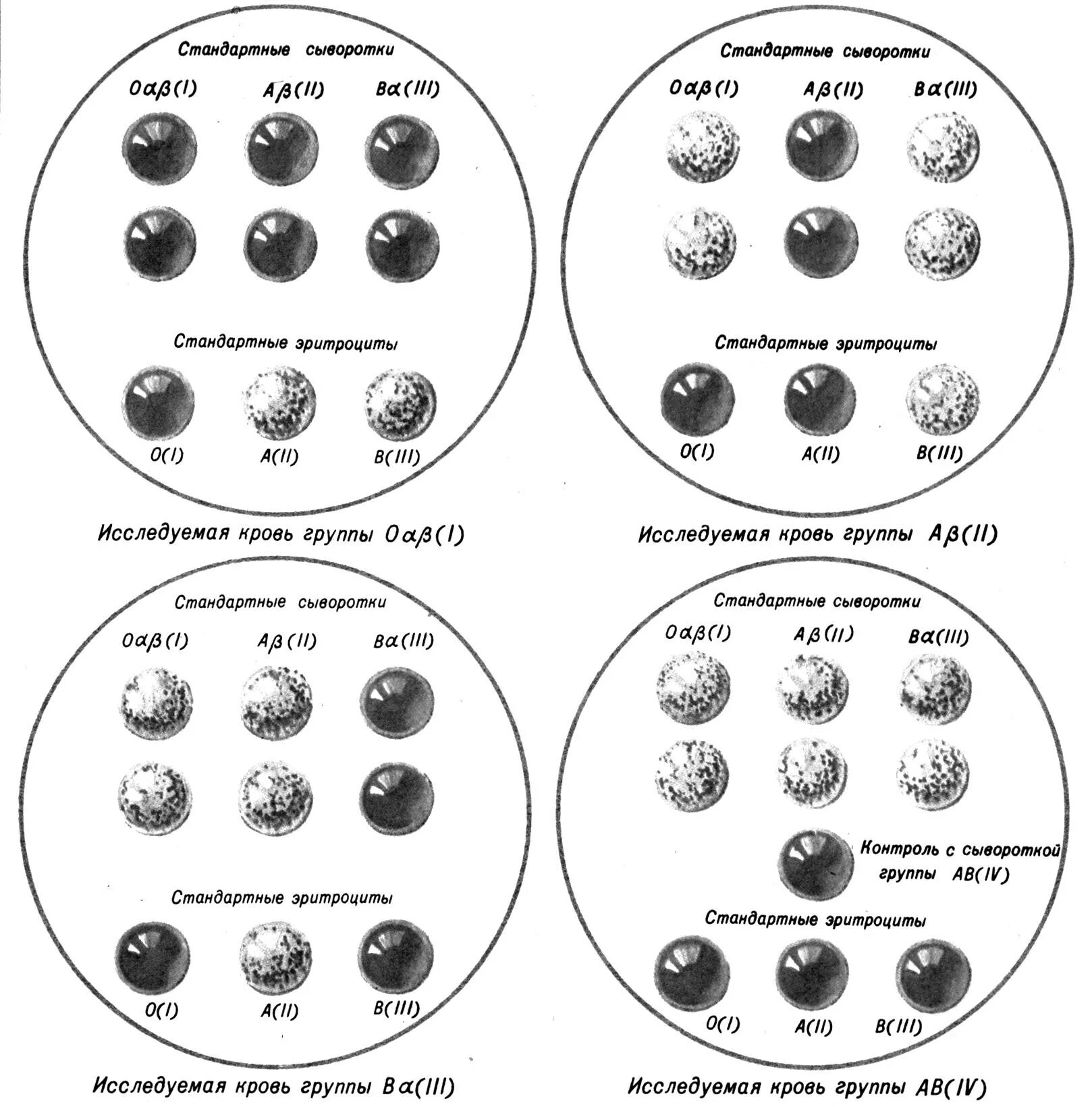 Метод перекрестные группы. Определение группы крови методом агглютинации. Определение группы крови цоликлонами схема. Определение группы крови сыворотками и цоликлонами. Схема определения группы крови по стандартным сывороткам.