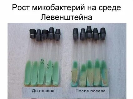 Микобактерии туберкулеза питательные среды