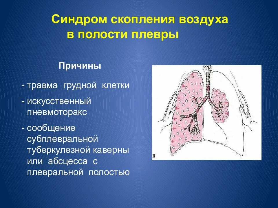 Образование полостей в легких