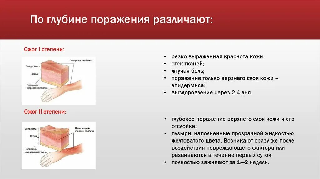 Установите соответствие степени ожога. Ожог 2 степени глубина поражения ткани. Глубина ожога при 1 степени. Степени ожогов по глубине поражения. Глубина ожогов по степеням.