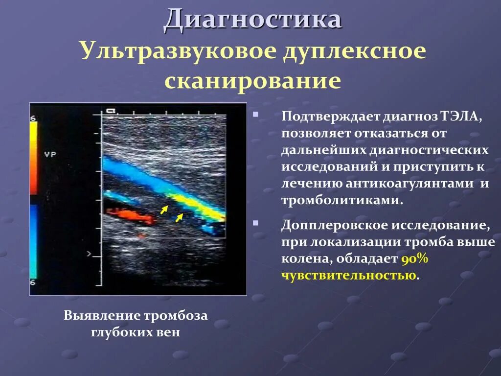 Как называется узи вен. Ультразвуковая допплерография сосудов. Ультразвуковая допплерография артерий нижних конечностей. Ультразвуковое дуплексное ангиосканирование. Допплеровское исследование сосудов конечностей.