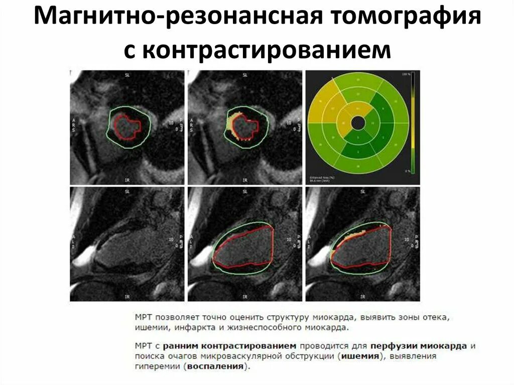 Кт исследование что это такое