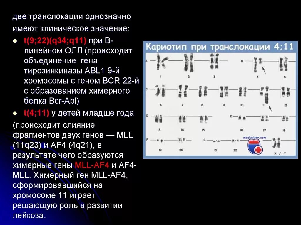 Дауна кариотип транслокационный. Робертсоновская транслокация кариотип. Кариотип при транслокации. Транслокация хромосом кариотип. Мужская хромосома 5