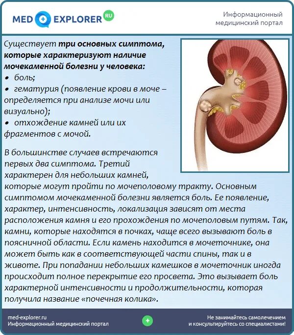 Что пить когда болят почки. Заболевание почек мочекаменная болезнь симптомы. Заболевания мочевыделительной системы мочекаменная болезнь. Почка при мочекаменной болезни.