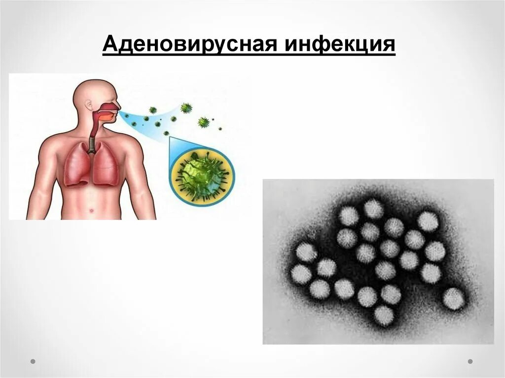 Аденовирусная инфекция эпидемиология. Аденовирусная инфекция пути заражения. Аденовирусная инфекция этиология. Аденовирус способ передачи. Аденовирус гриппа