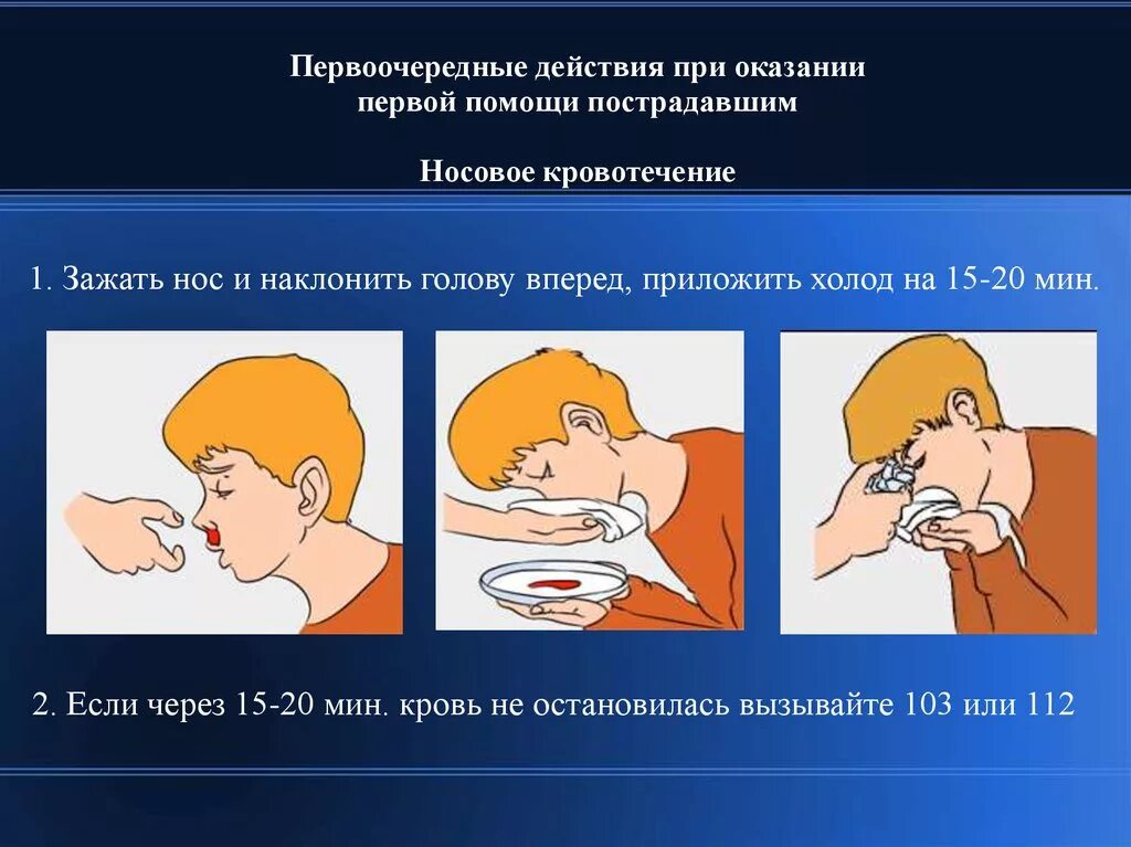 Какова помощь при носовом кровотечении. Пмп при кровотечении из носа. оказание первой помощи пострадавшему при кровотечении из носа. оказание 1 помощи при носовом кровотечении.