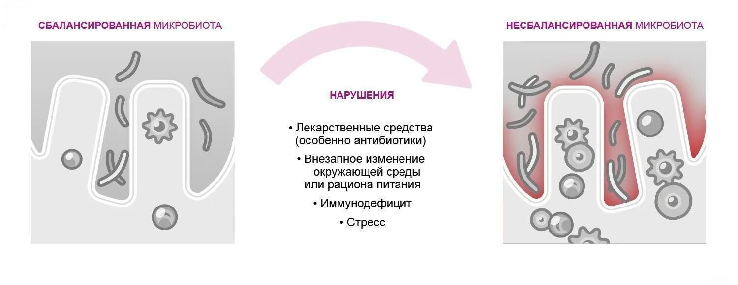 Расстройство микрофлоры. Антибиотики подавляют микрофлору рисунок. стресс иммунитете и кишечная микробиота. баланс микрофлоры кишечника. микробиота ребенка.