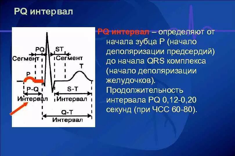 ЭКГ интервал PQ 140 МС. Интервал PQ норма 0.22. Интервал PQ на ЭКГ норма. QRS интервал PQ. Мв на экг