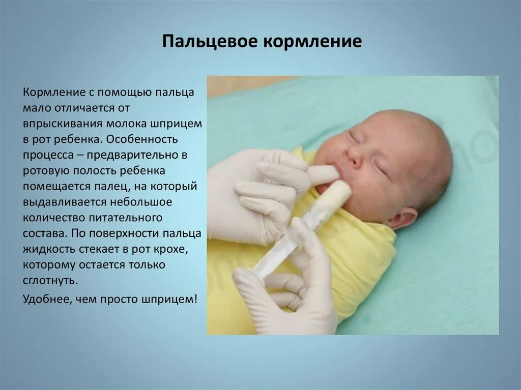 Признаки лактации. Пальцевое кормление. Пальцевое кормление новорожденного. Пальцевое кормление из шприца. Кормление ребенка с пальца.