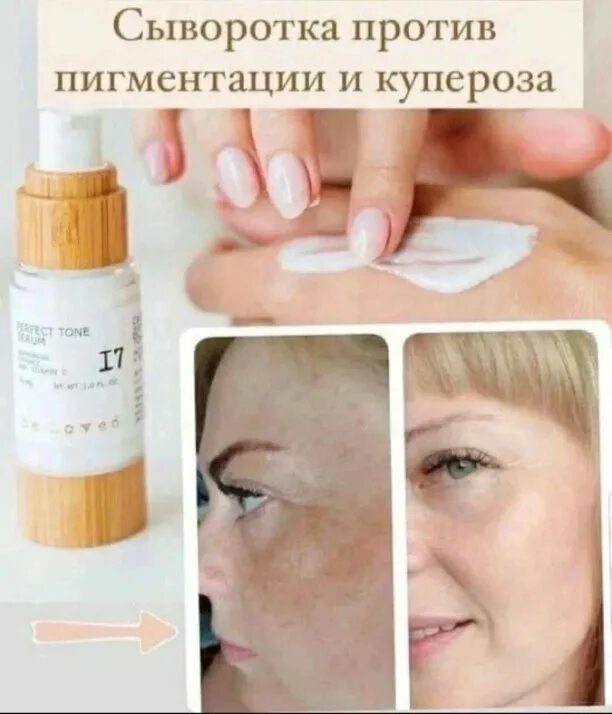 От пигментации кларанс сыворотка. Сыворотка нл для лица. Крем от веснушек и пигментных пятен. Против пигментации. Средства тт пигментацит.