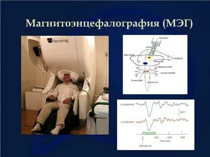 Нейромаг