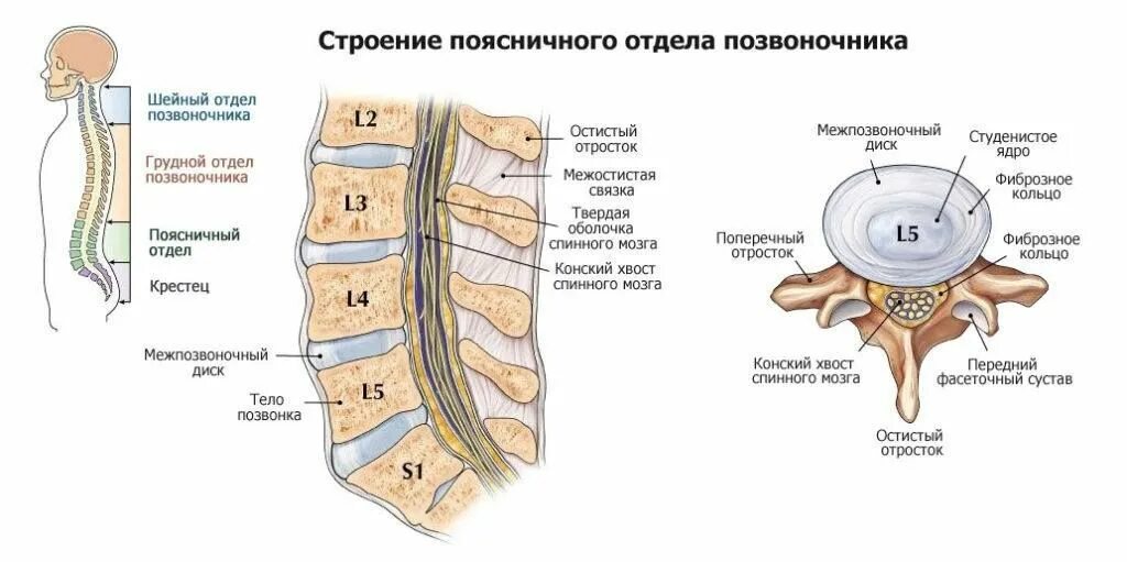 Задняя протрузия диска l5