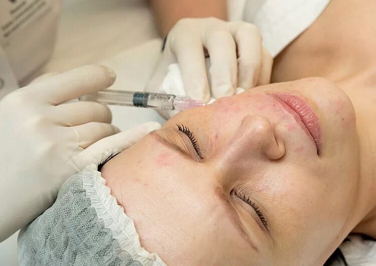 Мезотерапия кожи лица skinlift ru. Инъекции мезотерапии. Инъекционная мезотерапия. Аппаратная и инъекционная мезотерапия.