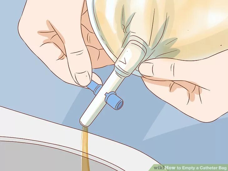 Amazon.com: Dale Tracheostomy Tube Holder