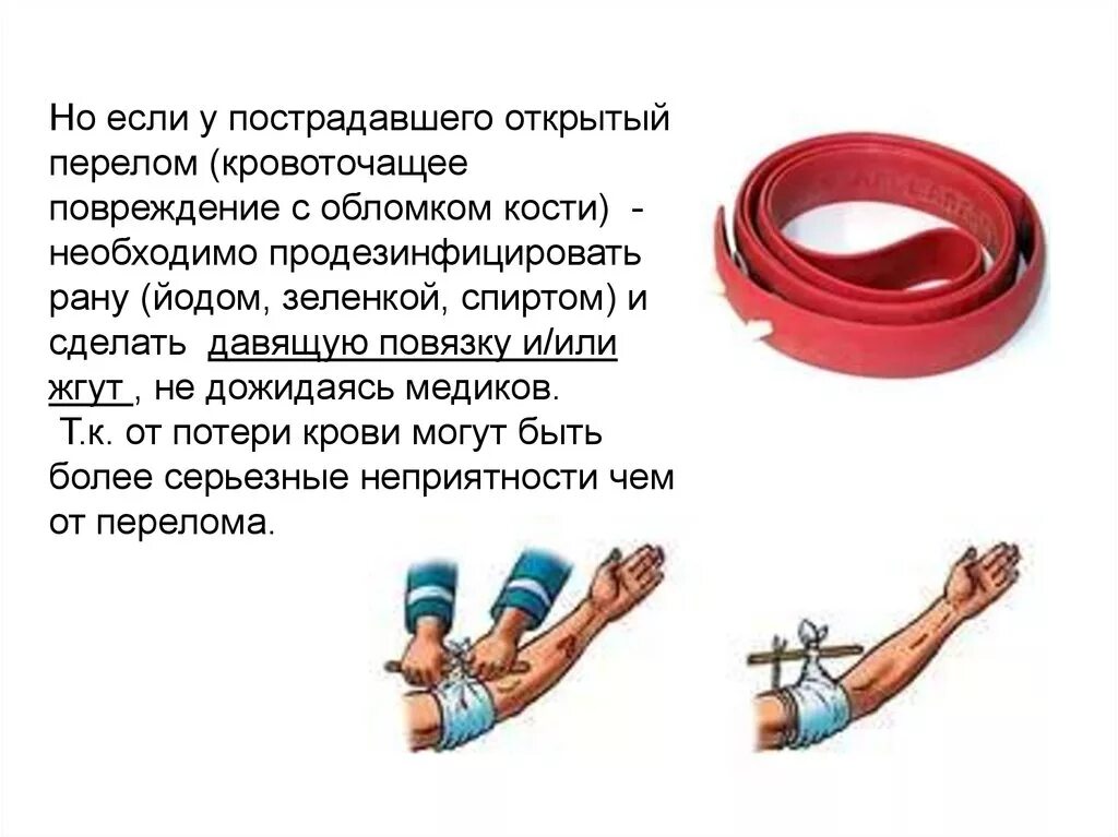 Жгут при открытом переломе. Первая медпомощь при открытом переломе. кровоостанавливающий жгут при открытом переломе. при открытом переломе пострадавшему необходимо. наложение жгута при открытом переломе.