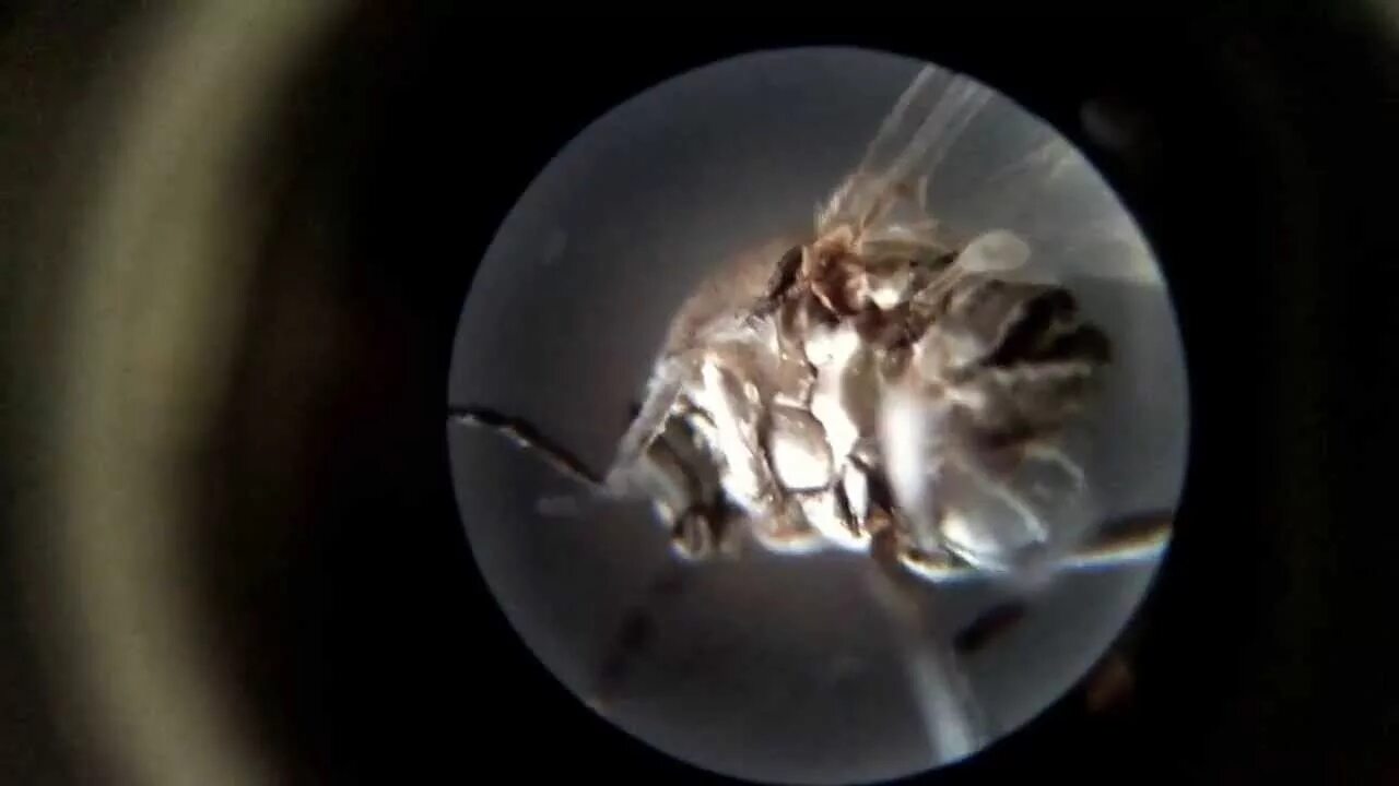 Мошка под микроскопом фото. Зубы Астраханской мошки под микроскопом. Мошка под микроскопом челюсти и зубов. Мошка под микроскопом челюсти. Зубы мошкары под микроскопом.