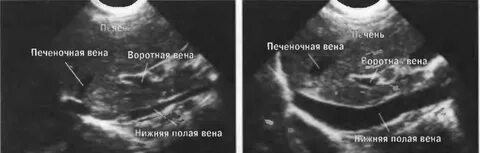 Узи где находится