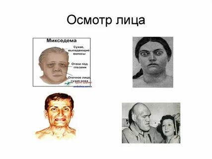 Осмотр лица