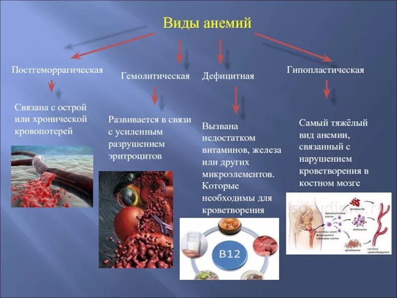 Формы постгеморрагической анемии. Постгеморрагическая анемия и гемолитическая анемия. Постгеморрагическая анемия гемоглобин. Тип анемии при дефиците железа.