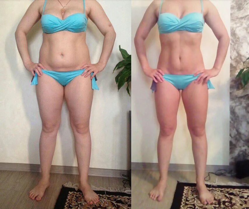 толстые женщиныдо ипоже. висит кожа после похудения. сильно похудела что делать. сильно похудела что делать. сильно похудела что делать.