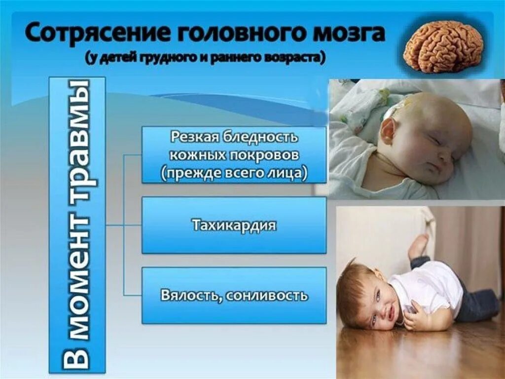 Сотрясение мозга до года. Сотрясение мозга у ребенка. Сотрясение мозга симптомы у детей. Симптомы сотрясения мозга у детей до года. Симптомы сотрясения у ребенка до года.