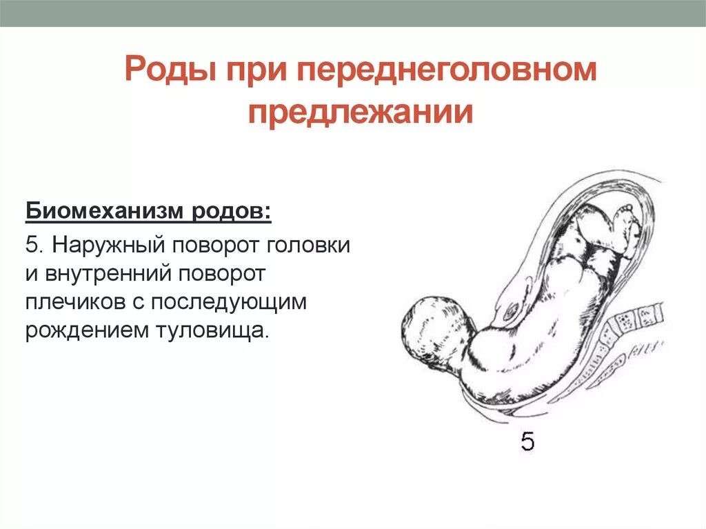 Биомеханизм переднеголовном предлежания плода. Биомеханизм родов в переднеголовном предлежании. Разгибательные предлежания головки плода: переднеголовное. Биомеханизм родов при переднеголовном предлежании. Переднеголовное предлежание