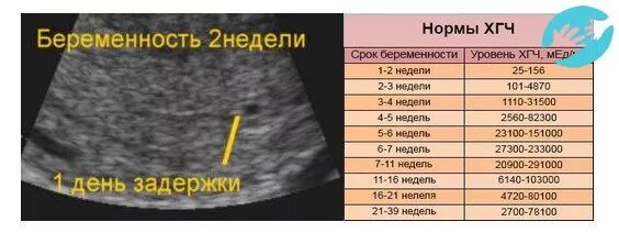Через 3 4 дня начинает