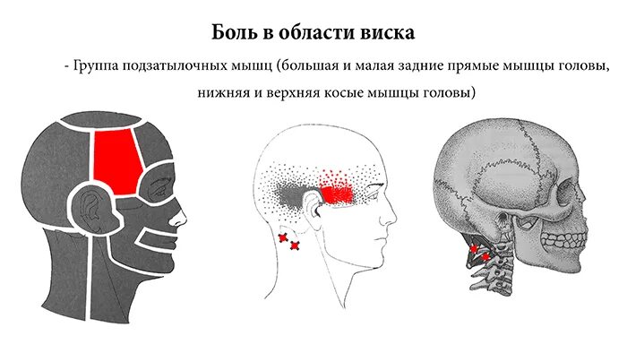 Колет висок