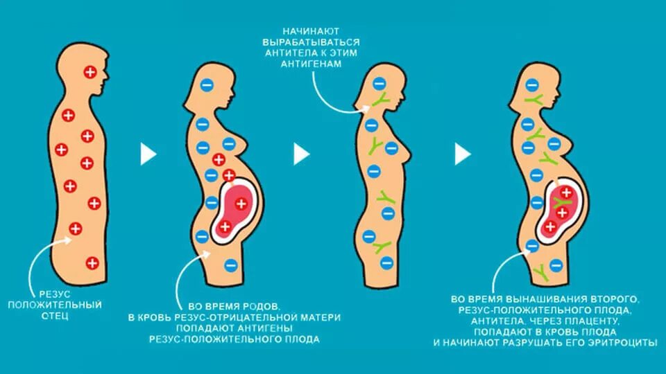 Конфликт резус факторов при беременности у родителей. Положительный резус фактор матери и отрицательный плода. Несовпадение резус факторов матери и ребенка. Резус конфликт рисунок. Резус фактор у беременных