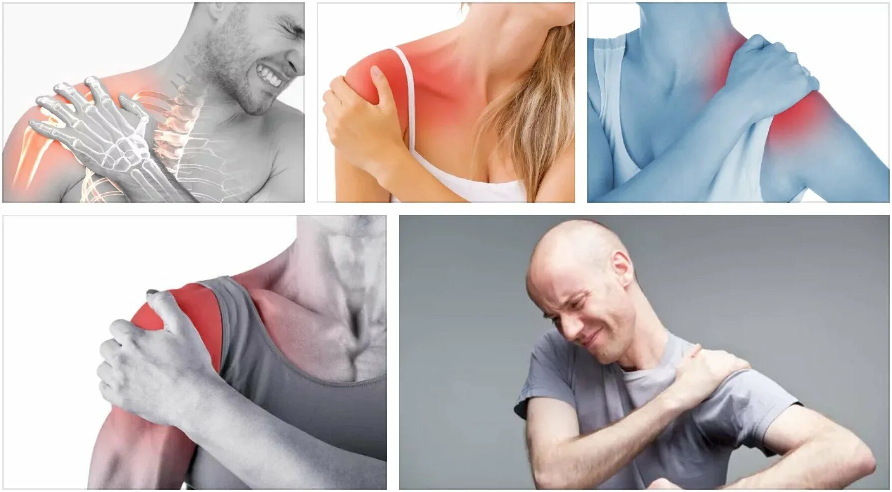 Травмы мышц и сухожилий. Растяжение плечевых связок. Разрыв плечевых связок. Растяжение связок плечевого сустава. Растяжения, разрывы связок и мышц.