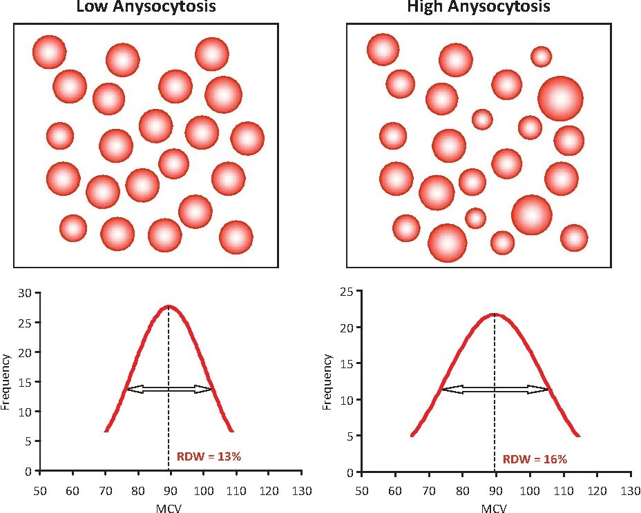 Rdw в анализе крови. Распределение эритроцитов по объему (RDW CV). Показатель RDW CV % это что. Распределение эритроцитов по величине.