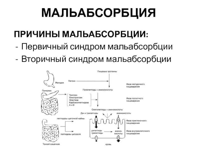 Синдром мальабсорбции препараты. Тонкий кишечник мальабсорбция. биохимические причины мальабсорбции. первичный синдром мальабсорбции.