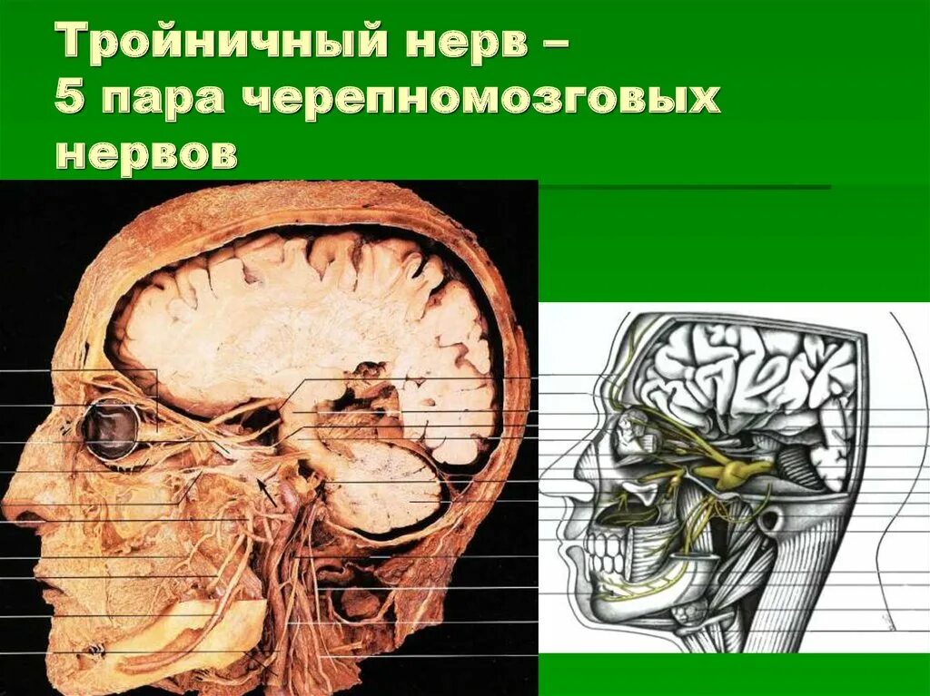 Тройничного нерва 9 букв. Топография тройничного нерва проекция. Тройничный нерв. Тройничный нерв анатомия. Лицевой и тройничный нерв анатомия.