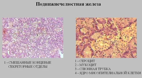 Препарат околоушной железы. Гистологический препарат смешанная слюнной железы. Околоушная железа гистология препарат. Слюнные железы гистология препарат. Подчелюстная железа гистология.