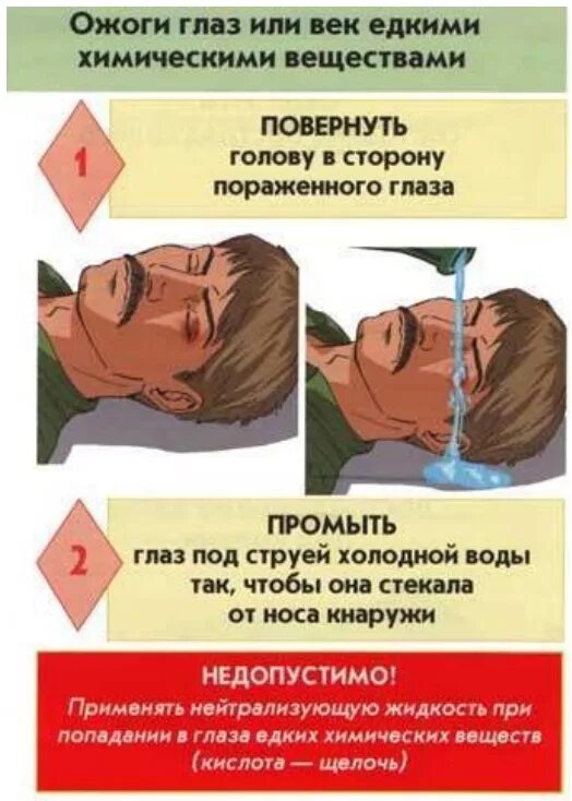 Оказание первой помощи при ожогах глаз. При химических ожогах глаз.