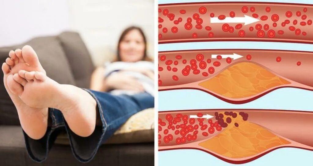 Почему на ногах остаются следы. Отпечаток на коже от резинки. Красные точки на ногах после бритвы. Фолликулярный катороз. Почему на ногах остаются следы.