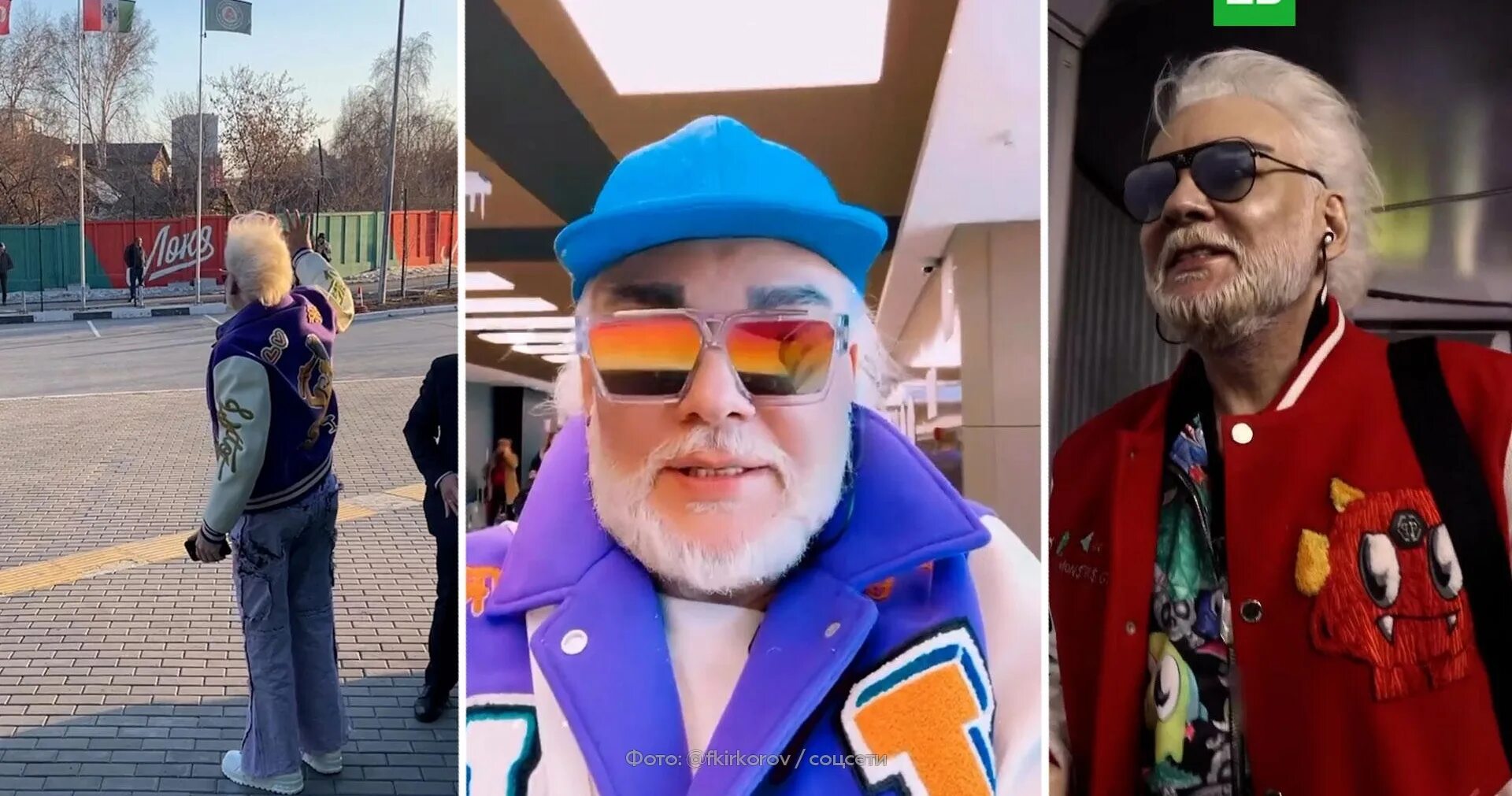Киркоров после пластики фото сейчас. Киркоров после пластики фото сейчас