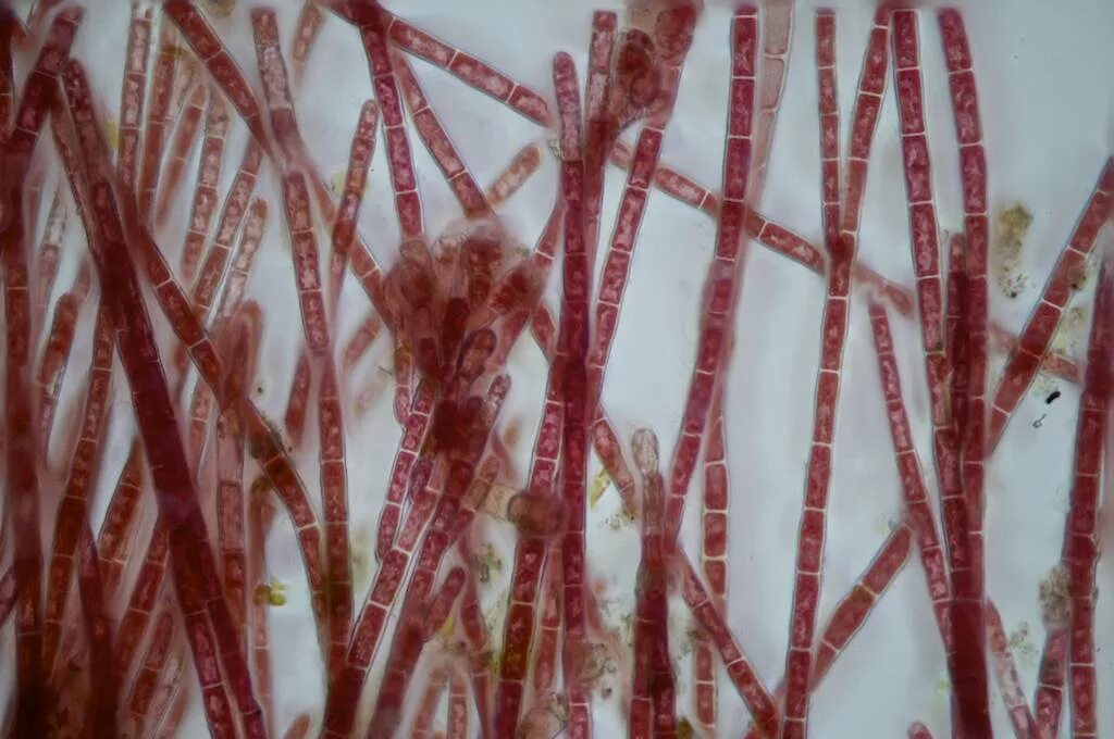 Красные водоросли клетки. Rhodochorton purpureum. Церамиум водоросль. Нитчатые водоросли микроскоп. Нитчатые багрянки.