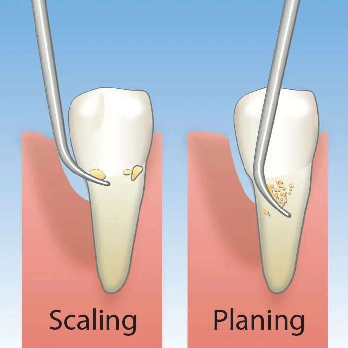 Сайт scaling