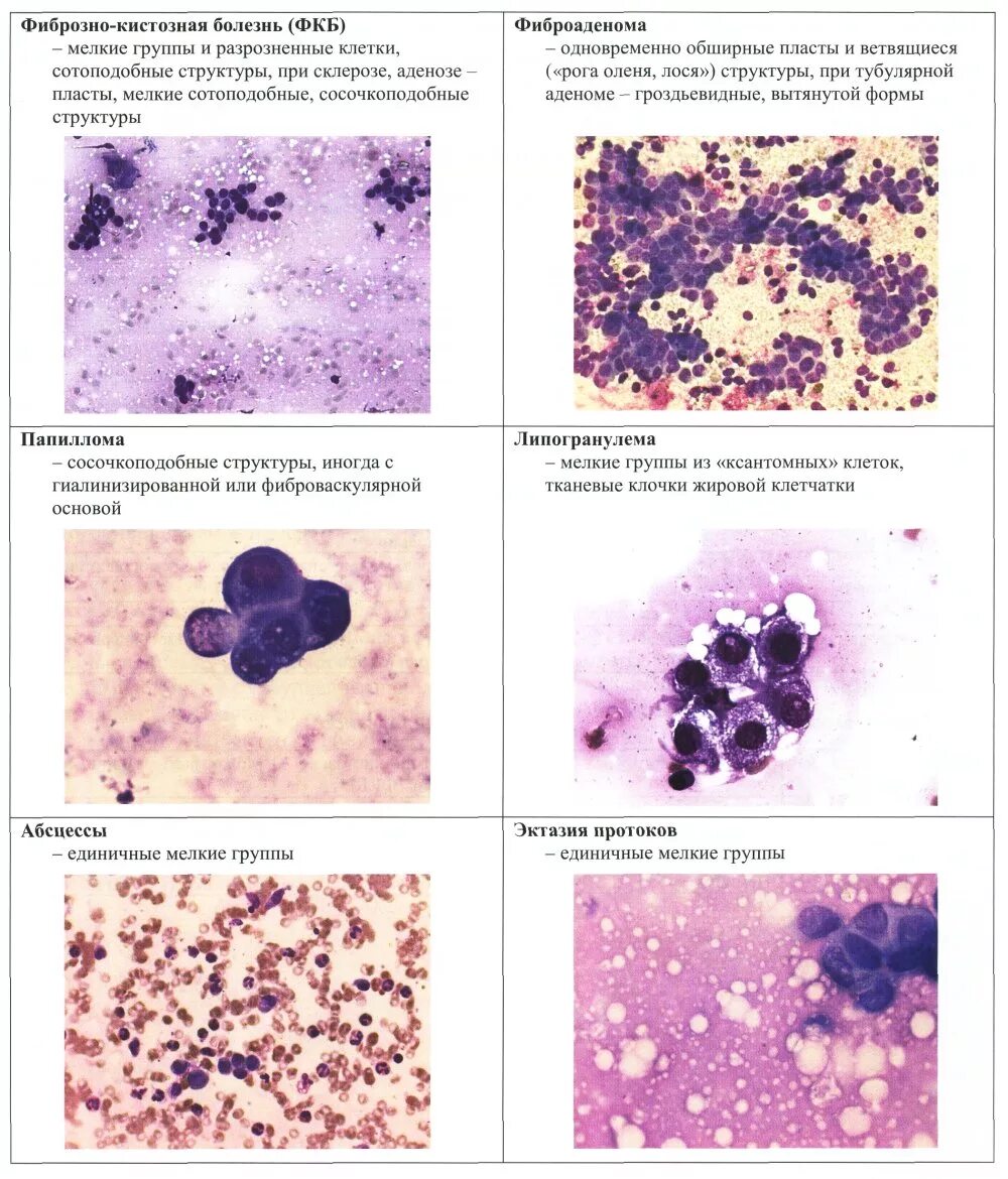 Мазки на флору и цитологию. Расшифровка анализа цитологического исследования шейки матки. Норма цитологического исследования мазка. Цитология при месячных. Цитология при месячных.