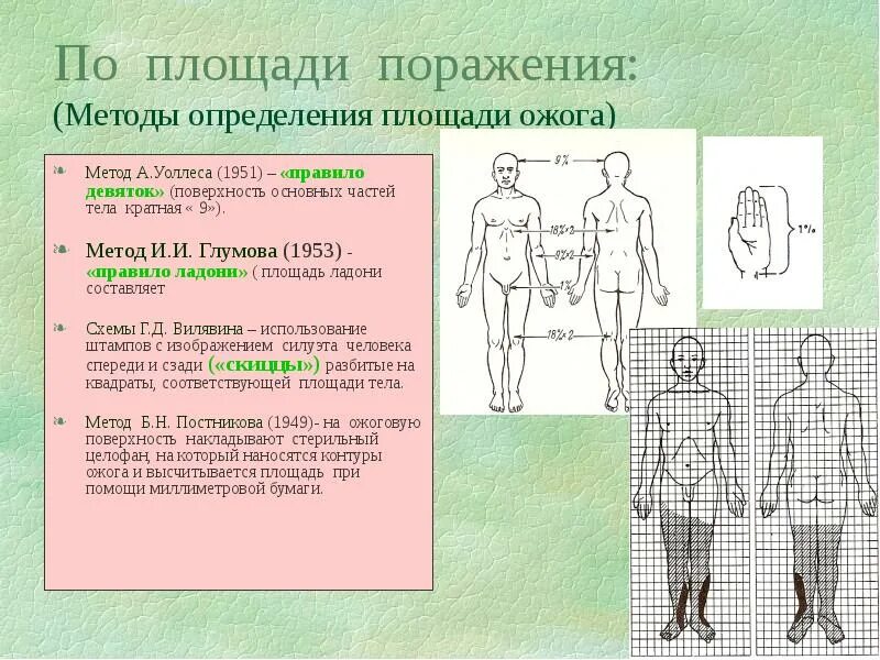 Method 9 method. Схемы Вилявина для определения площади ожога. Метод и.и. Глумова (1953) - «правило ладони» ( площадь ладони составляет. Методы определения площади ожога. Способы определения площади ожоговой поверхности.