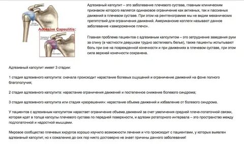 Лечение плечевого сустава симптомы