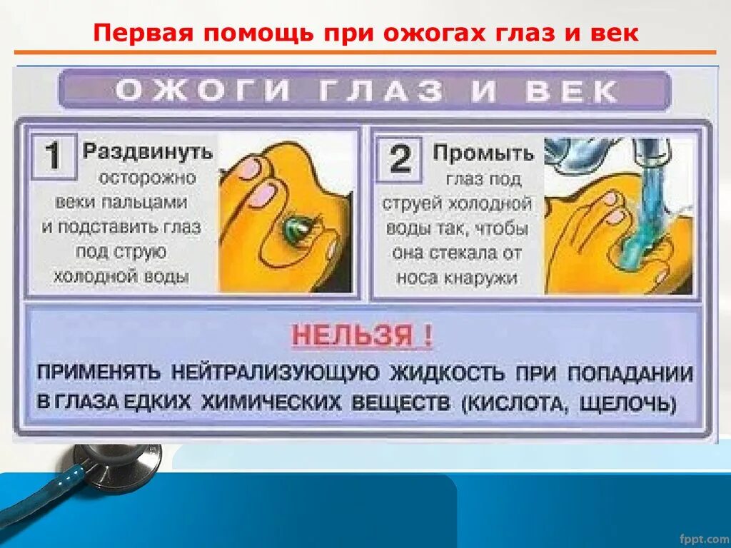 Что делать при термическом ожоге глаза. Пенрвая пномощь пни оженгах глаз. Первая помощь при ожогах глаз. Оказание первой помощи при химическом ожоге глаз. ПМП при химических ожогах глаз.