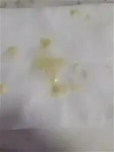 Что значит зеленая слизь