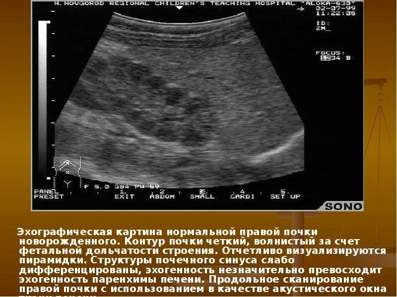 Эхогенность почки паренхимы повышена. Эхогенность повышена. Эхогенность повышена желчного пузыря. Пониженная эхогенность печени на узи. Эхоструктура почки.