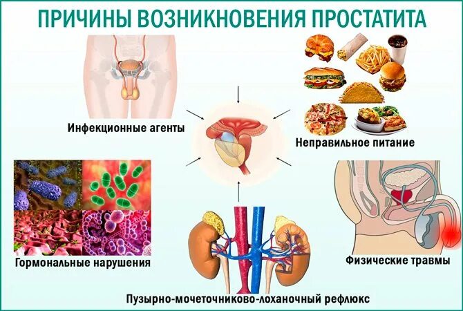 Причины возникновения простатита. Хронический простатит. Хронический бактериальный простатит. Небактериальный простатит