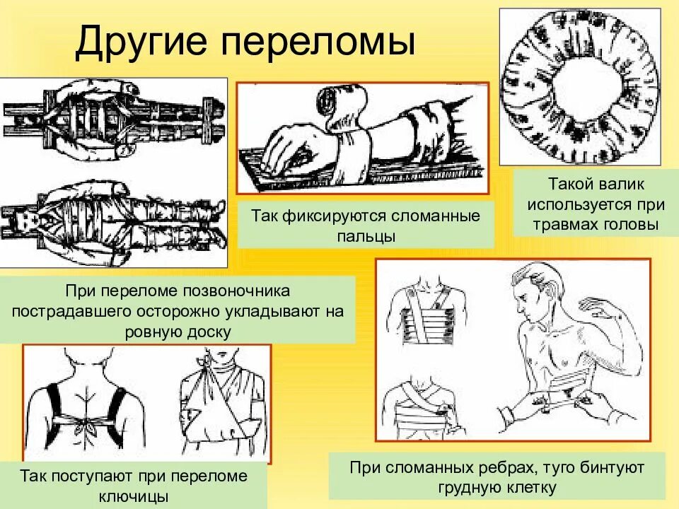 Доврачебная помощь при переломах вывихах растяжениях. Переломы и вывихи презентация. первая помощь при переломах. переломы и растяжения для презентации. первая помощь при травмах переломах растяжениях.