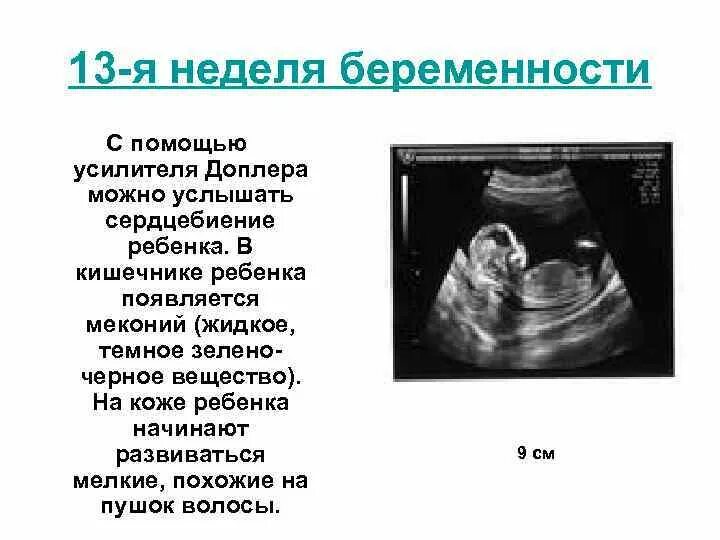 Можно почувствовать сердцебиение плода. Сердцебиение плода на УЗИ. 6 Неделя беременности сердцебиение ребенка. УЗИ 12 недель беременности сердцебиение плода. Сердцебиение плода на 13 неделе беременности.