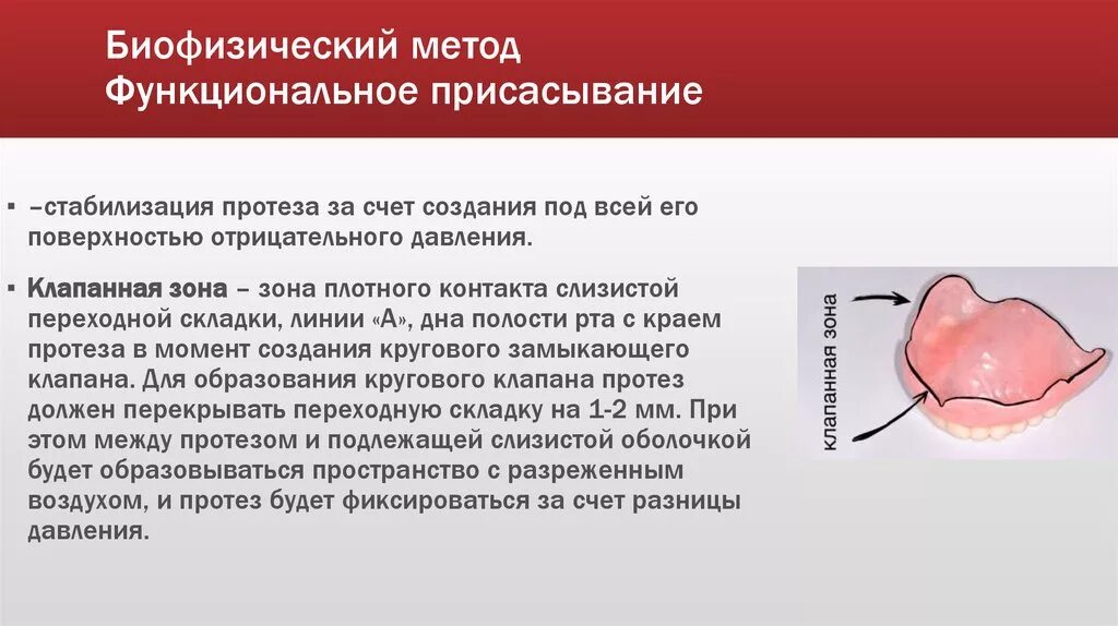 Границы пластиночного протеза. Методы фиксации и стабилизации съемных пластиночных протезов. Биофизические методы фиксации полных съемных протезов. Функциональная присасываемость протеза. Метод стабилизации протеза.